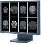 NEC MultiSync 2MP 21" LCD Medical Display (Blue Base)