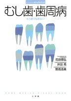 むし歯・歯周病 もう歯で悩まない